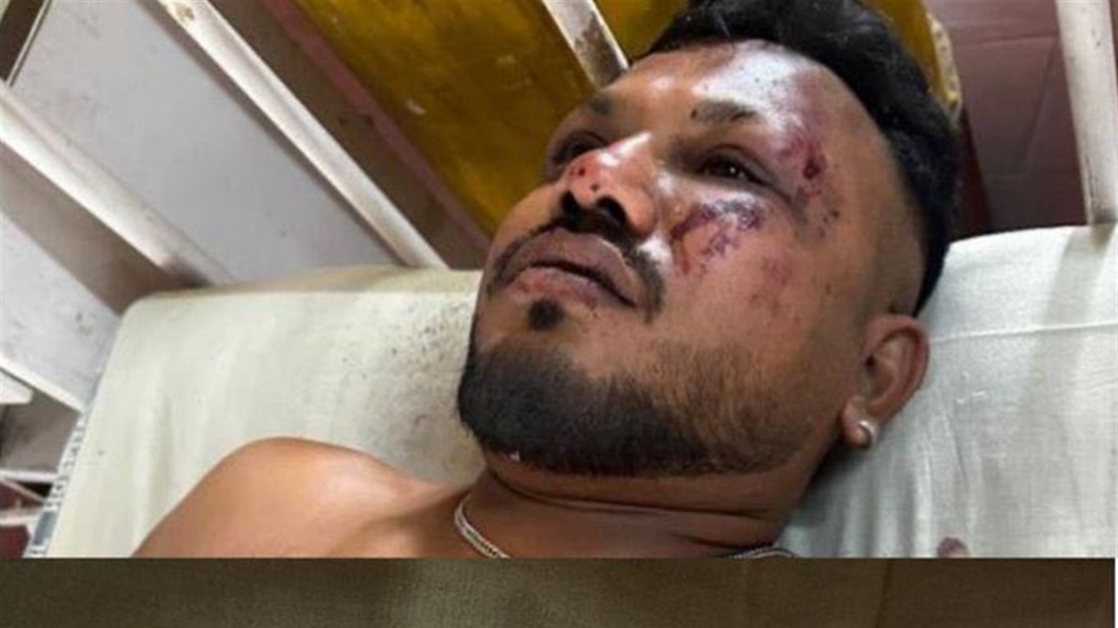 من بين 242 راكباً.. مشاهد لخروج الناجي الوحيد من تحطم الطائرة الهندية 